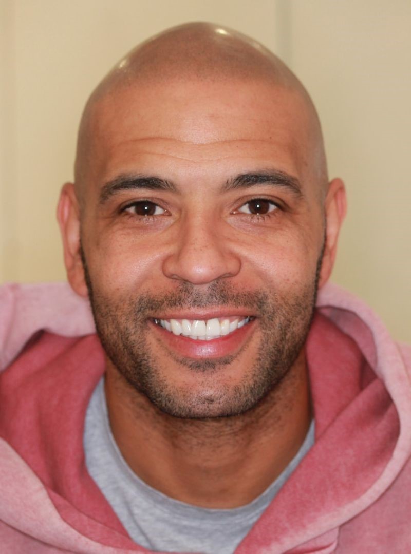 After Dental implant results