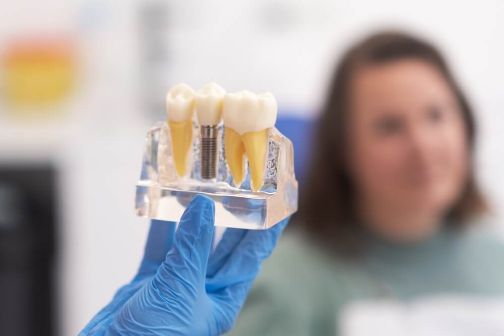 Dental implants Derby