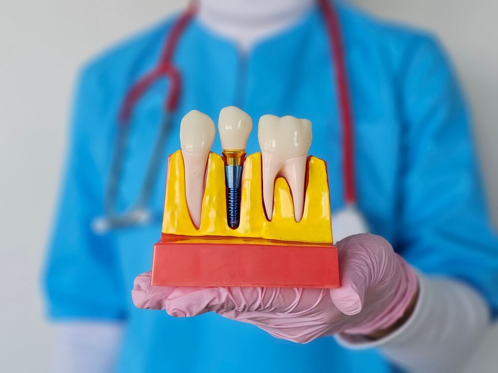 Implant dentistry Derby