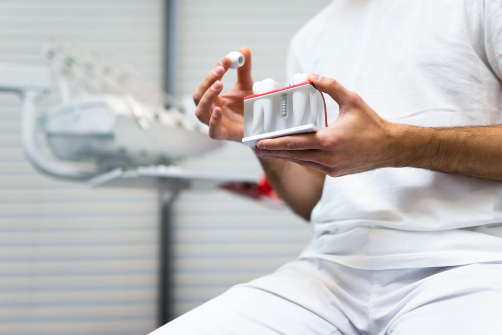 Same day dental implants Derby